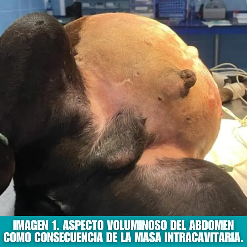 imagen1: abdomen voluminoso por masa intracavitaria