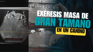 Exéresis quirúrgica de masa intracavitaria