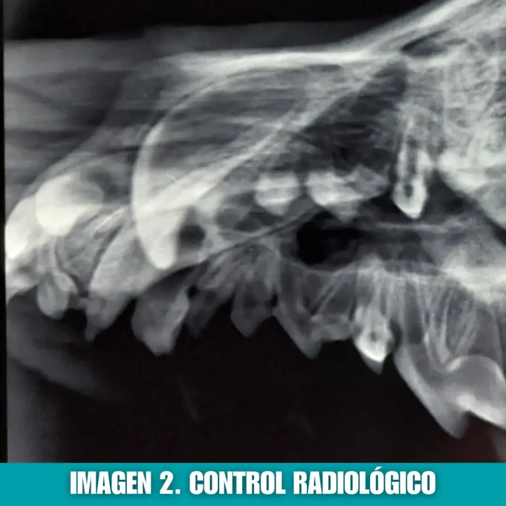 imagen 2: control radiológico