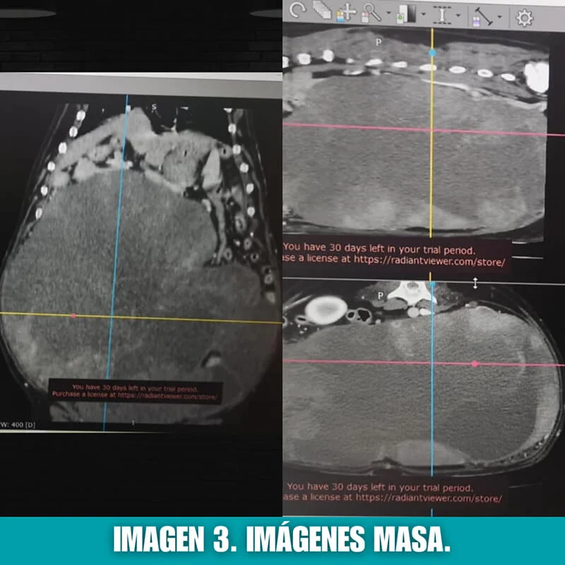 imagen 3: imagenes masa 2