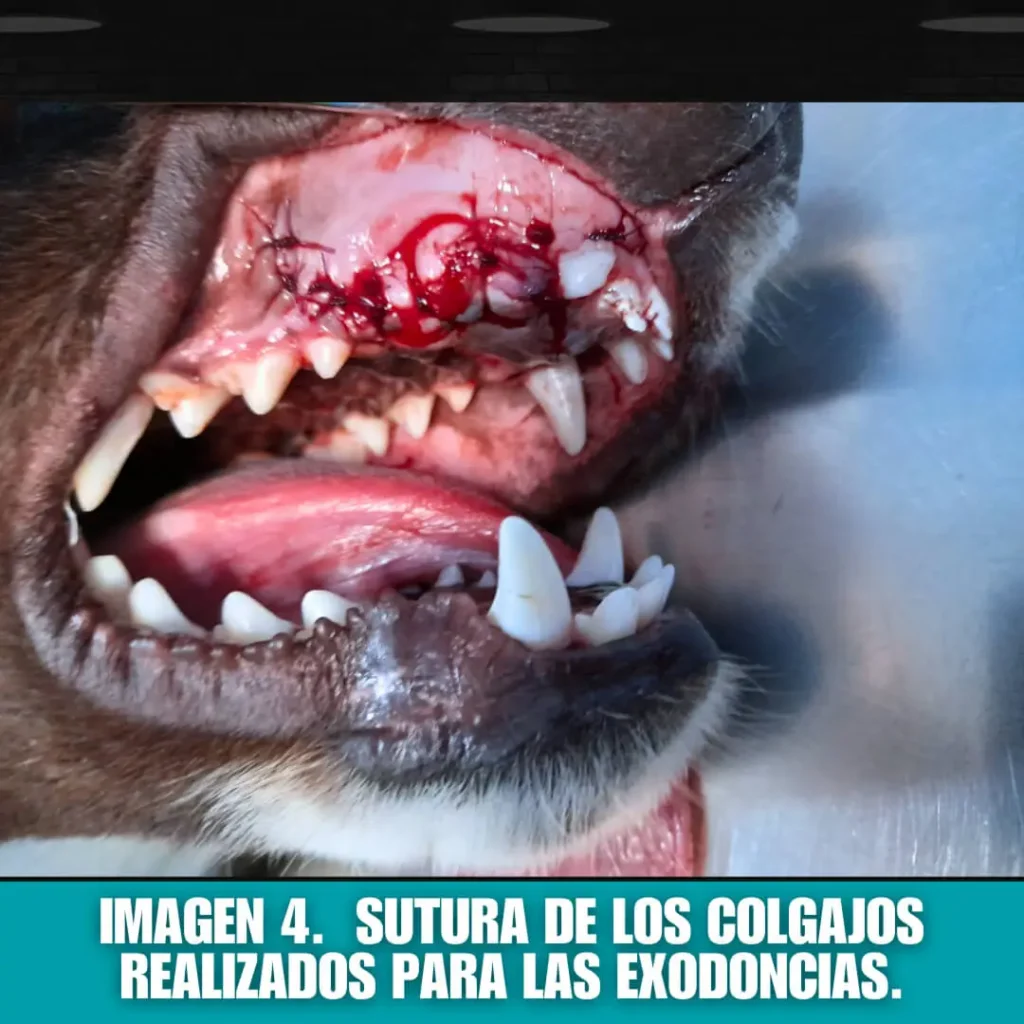imagen 4: sutura de colgajos realizados en exodoncias